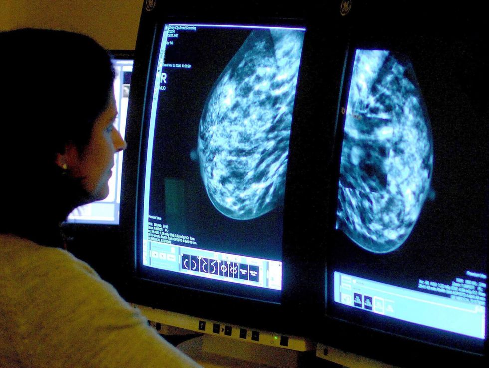 EMBARGOED TO 0001 FRIDAY OCTOBER 29 File photo dated 15/06/06 of a consultant analyzing a mammogram. At least one in five women have not checked for signs of breast cancer in the last year, a YouGov poll suggests. Issue date: Friday October 29, 2021.
