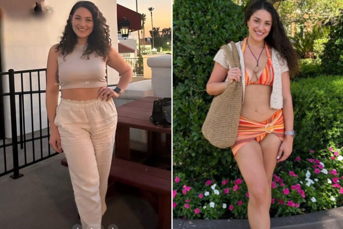 EMILY BEFORE AND AFTER