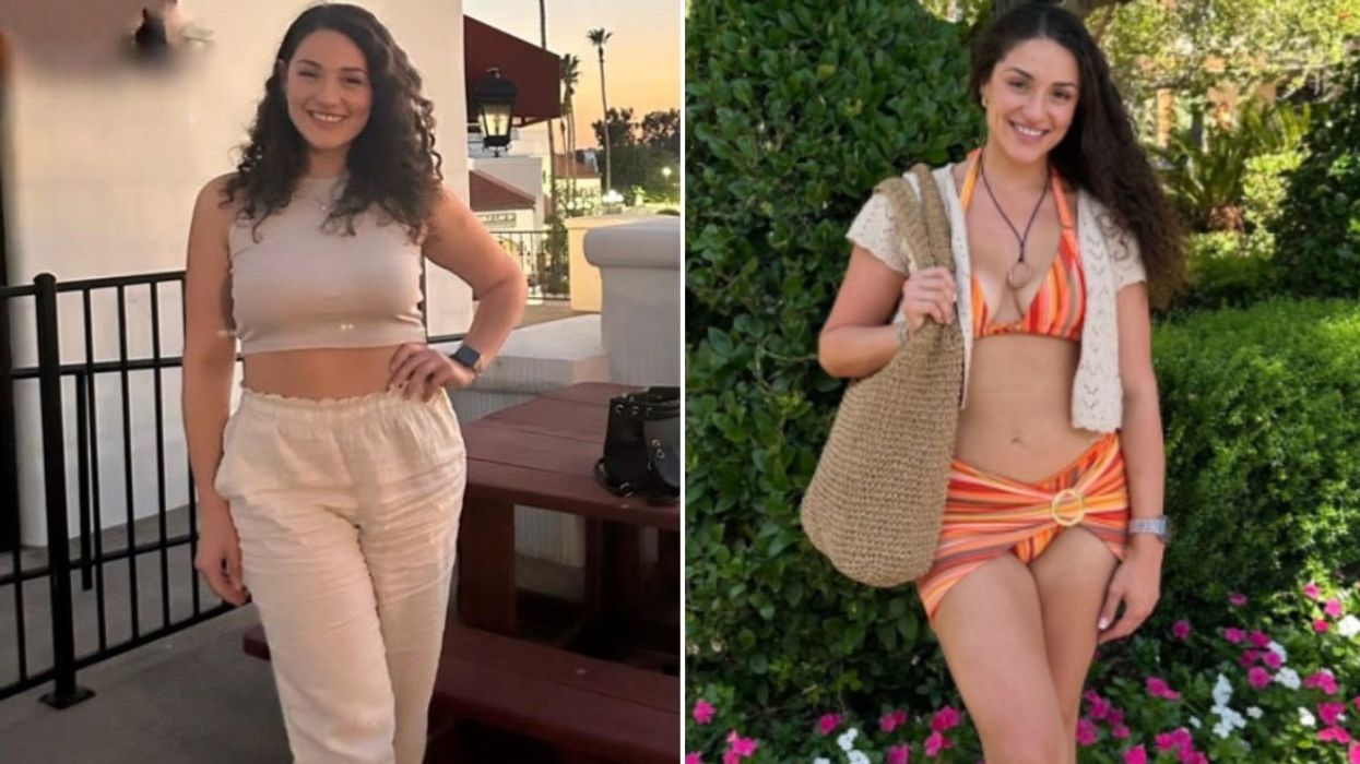 EMILY BEFORE AND AFTER