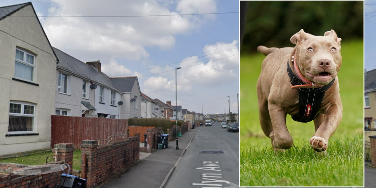 NextImg:XL Bully attack left 10-year-old in hospital after 'angry and vicious' attack