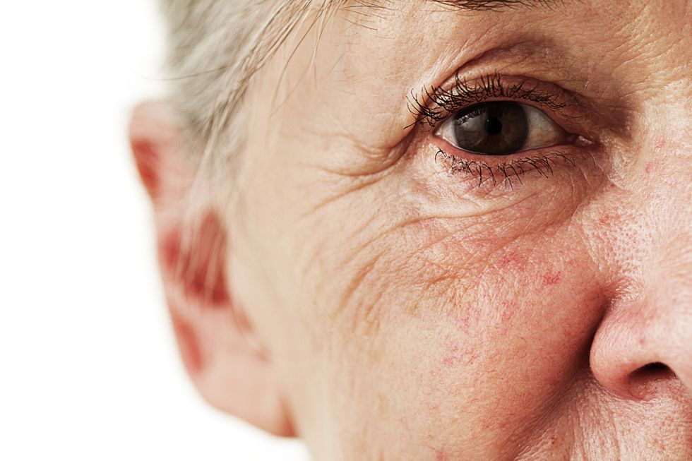 eyelids of senior woman stock image