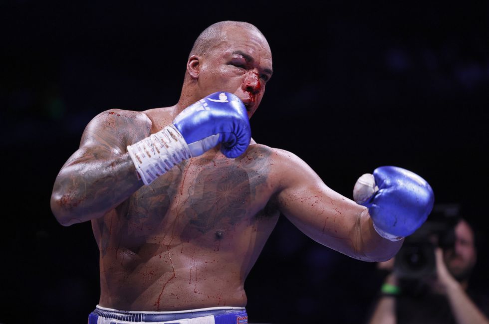 Fabio Wardley emerged from his gruelling WBO heavyweight title defeat to Daniel Dubois on Saturday in remarkably good physical shape, avoiding any trip to hospital despite the punishing nature of the contest