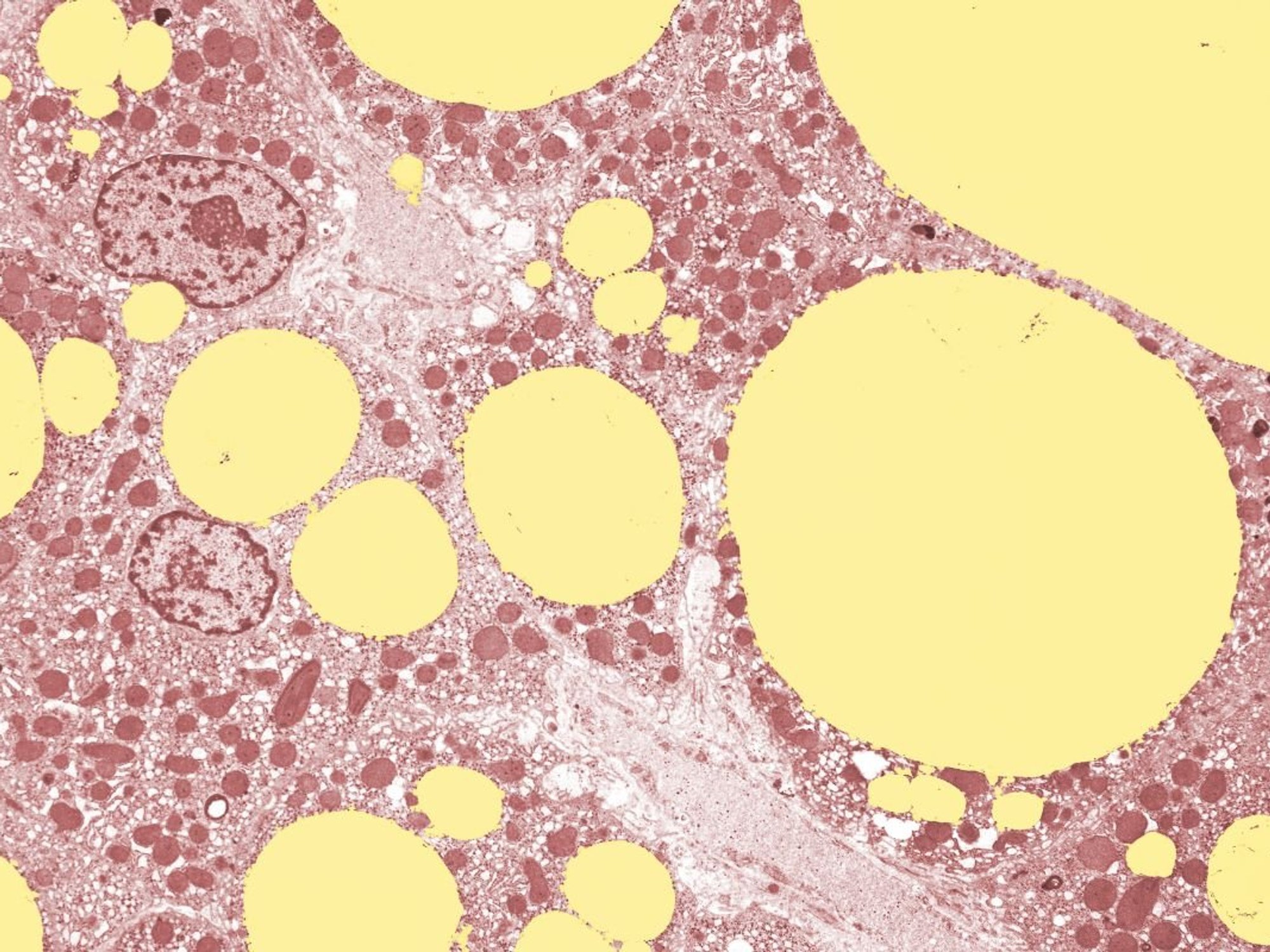 FAT CELLS IN THE LIVER