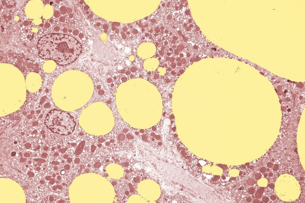 FAT CELLS IN THE LIVER