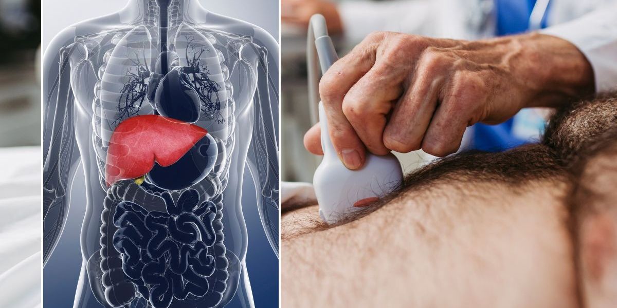 NextImg:Scientists make 'pivotal advance' in fight against fatty liver disease as new drug offers hope to millions