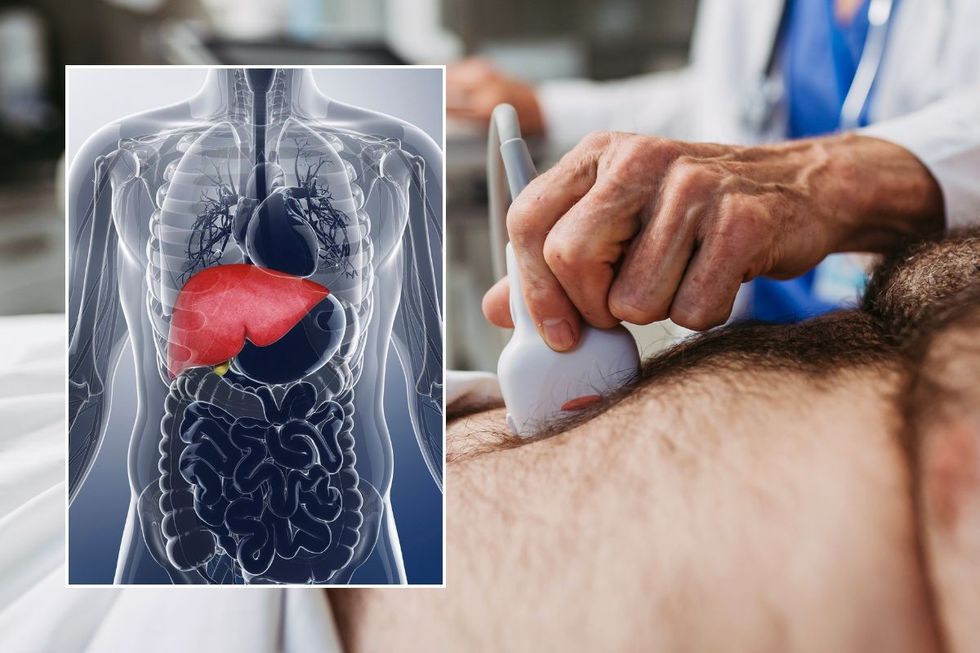 FATTY LIVER DISEASE