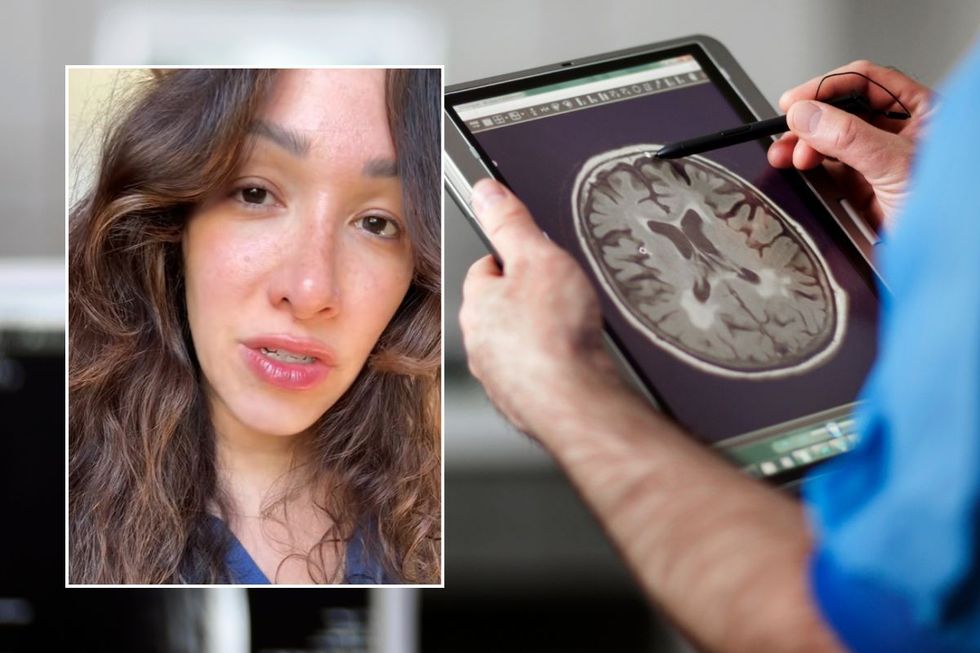 FEMALE NURSE AND BRAIN SCAN