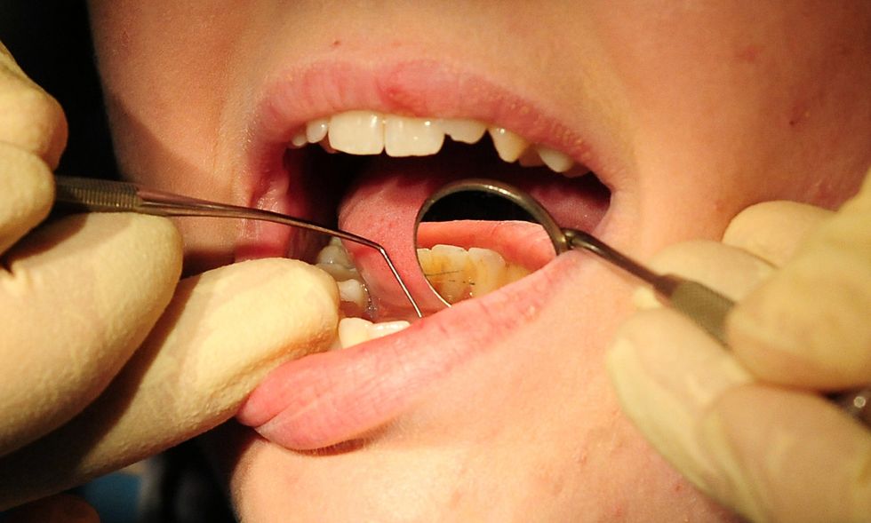 File photo dated 19/05/11 of a general view of a dentist at work. Thousands of high street dentists in England are %22severing ties%22 with the NHS, which could leave millions of patients %22with no options%22, leading dentists have warned. The British Dental Association (BDA) said that if the current trend continues %22this is how NHS dentistry will die%22. Issue date: Tuesday May 24, 2022.