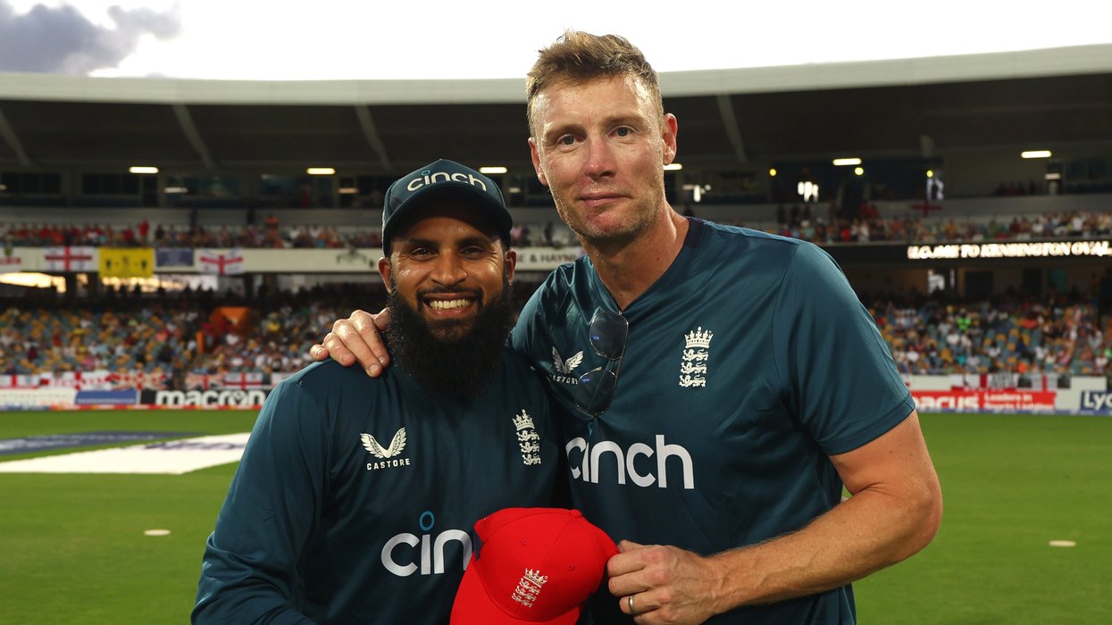 Freddie Flintoff's facial injuries looked to be healing