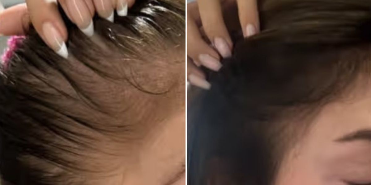 Hair care: ‘2 products thickened my hairline in less than a month Hair care: ‘2 products thickened my hairline in less than a month