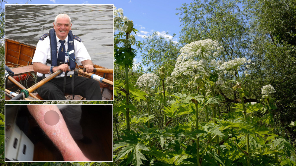 George Parsonage/Sore/Hogweed