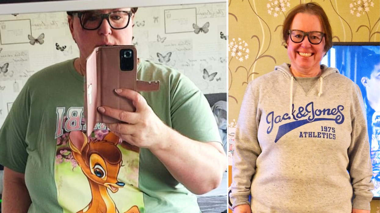 Gillian before/after weight loss