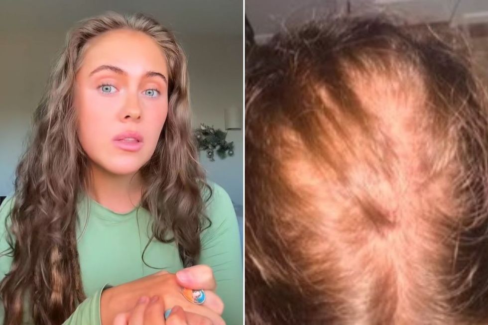 Gracie's hair growth transformation