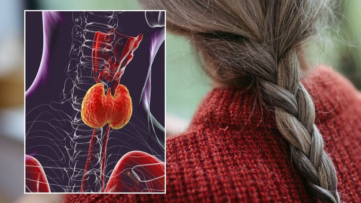 GREY HAIR AND THYROID ILLUSTRATION