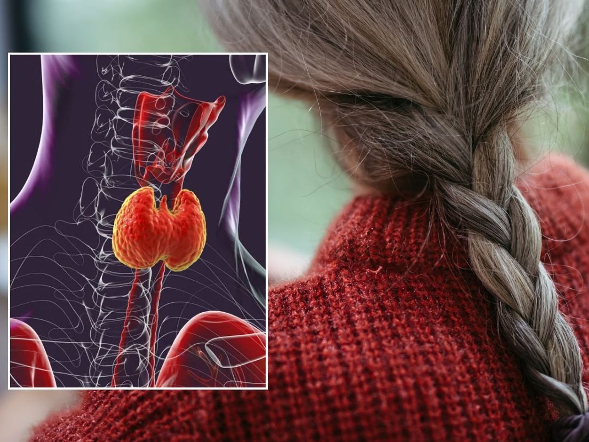 GREY HAIR AND THYROID ILLUSTRATION