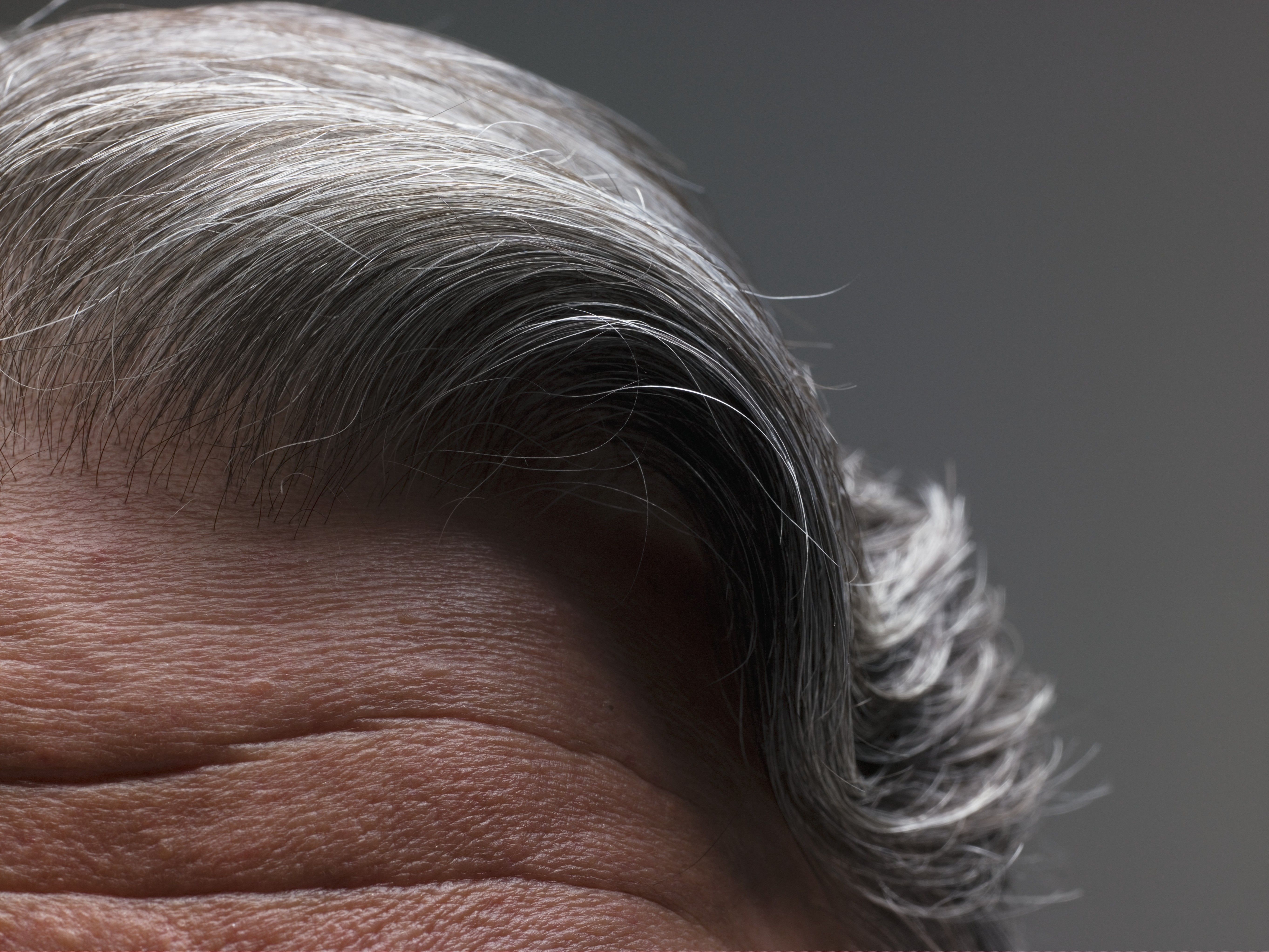 GREY HAIR