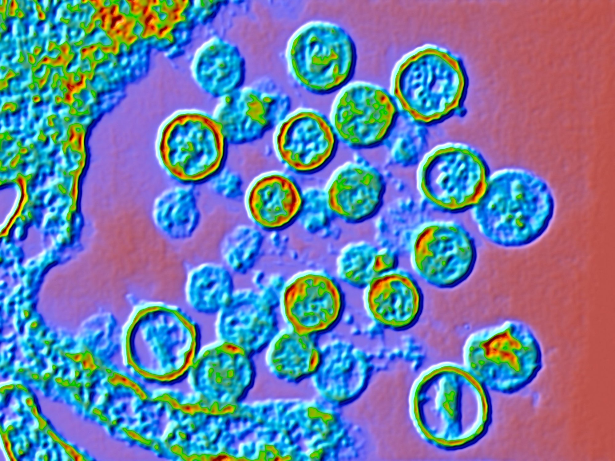 HANTAVIRUS UNDER MICROSCOPE