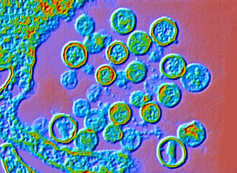 Hantavirus