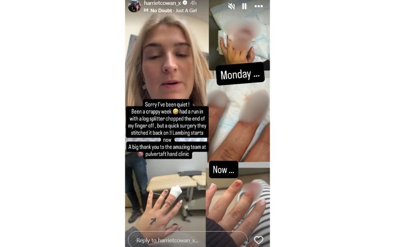Harriet Cowan shares gruesome photos as Clarkson's Farm star rushed to hospital following horror accident