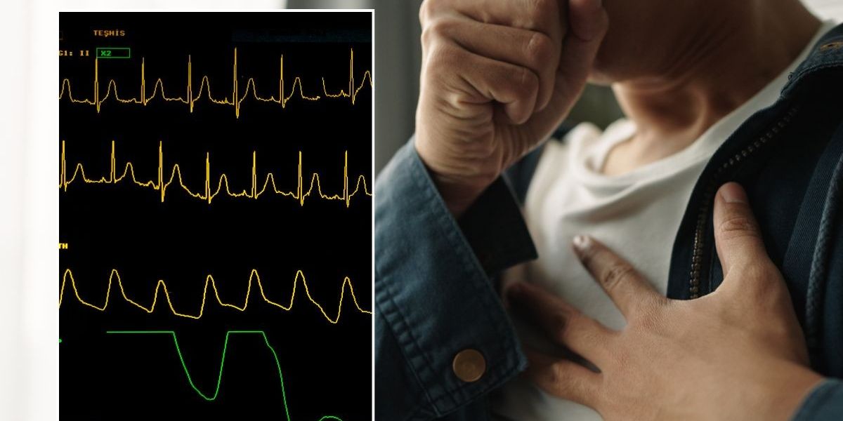 NextImg:Food choices part of ‘perfect storm’ driving rise in heart attacks among young people