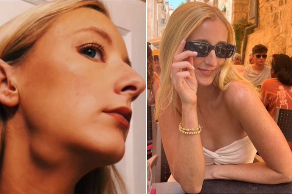 Cancer: ‘Doctors found 20 tumours – they all came from a small growth on my back that I ignored’