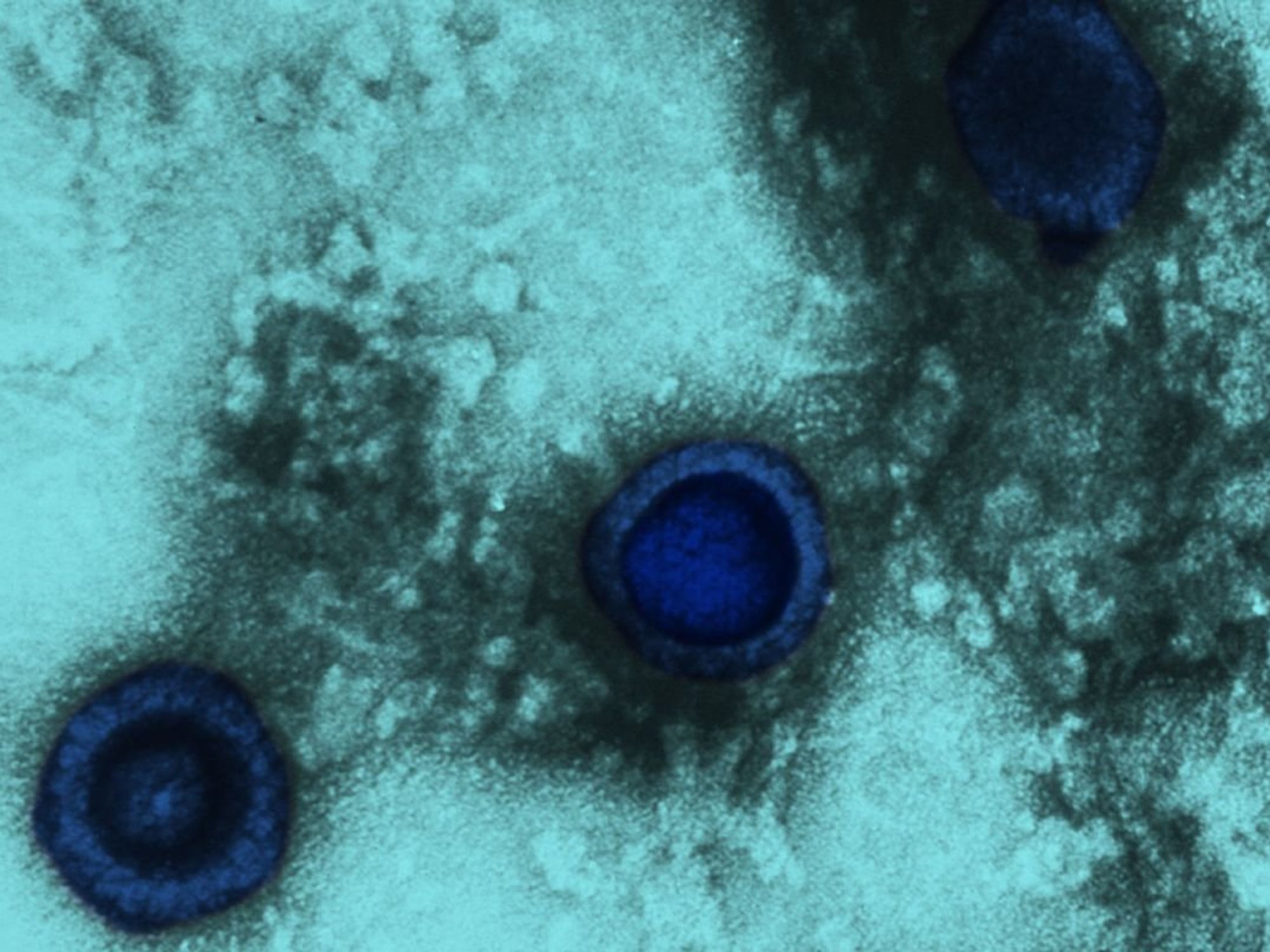 HERPES UNDER MICROSCOPE