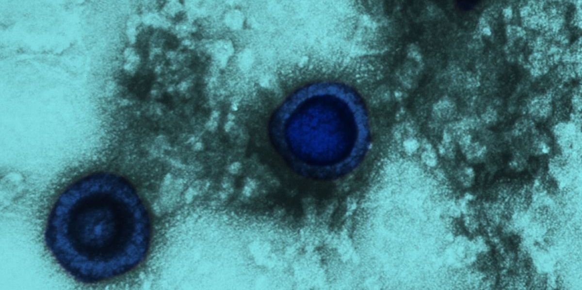 Health chiefs sound alarm as genital herpes infections rise across England