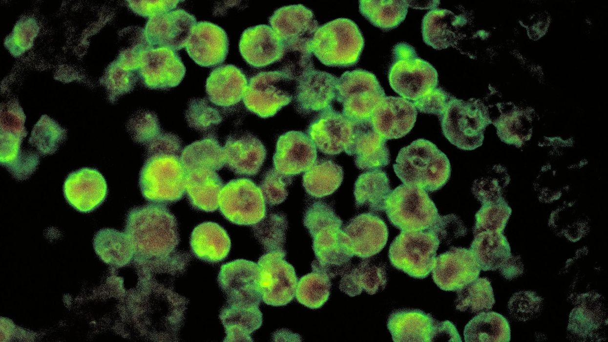 Holidaymakers given urgent warning as brain-eating bug kills second victim