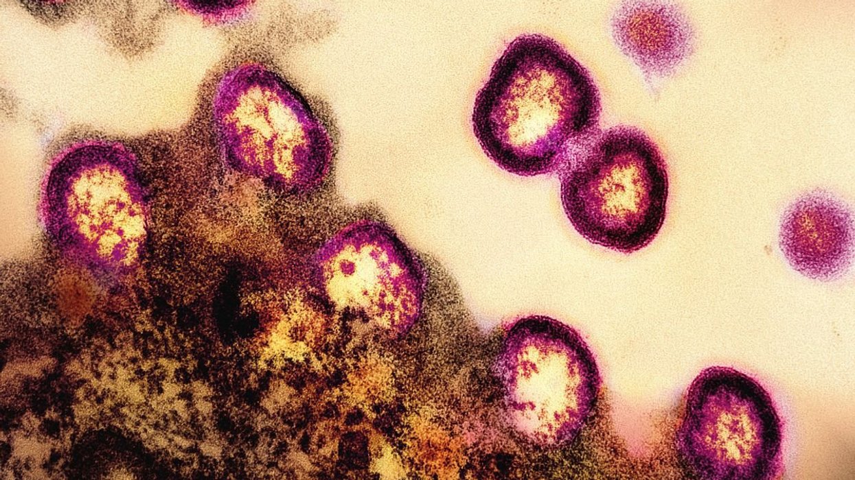 HIV-INFECTED CELL