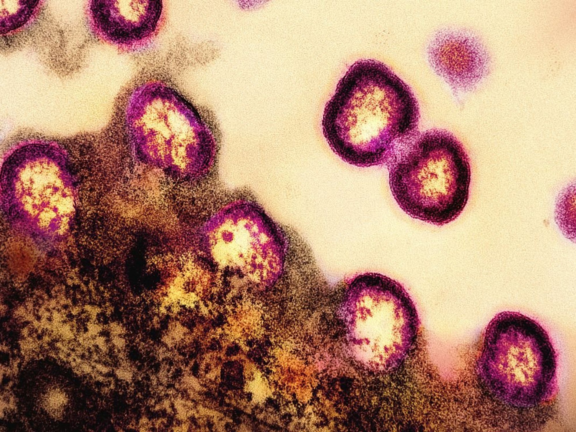 HIV-INFECTED CELL