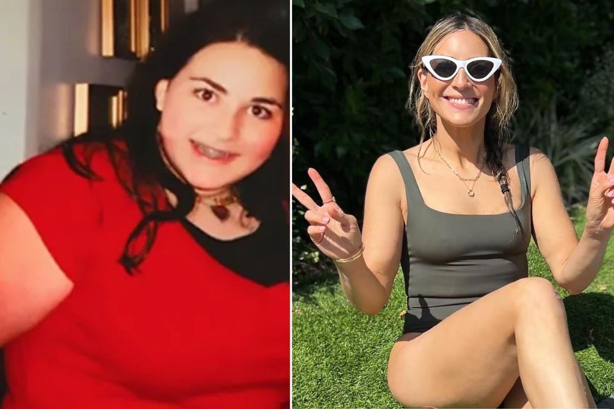 Ilana before and after