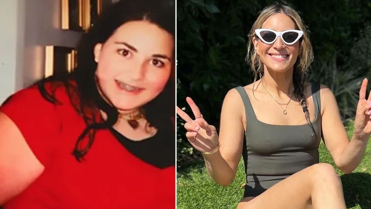 Ilana before and after