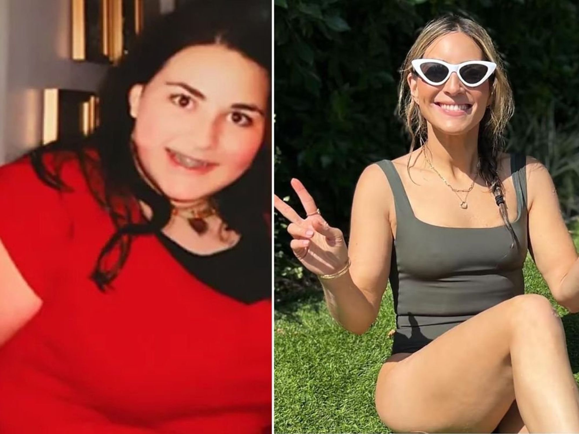 Ilana before and after