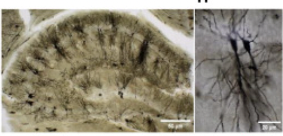 illustration of mouse brain