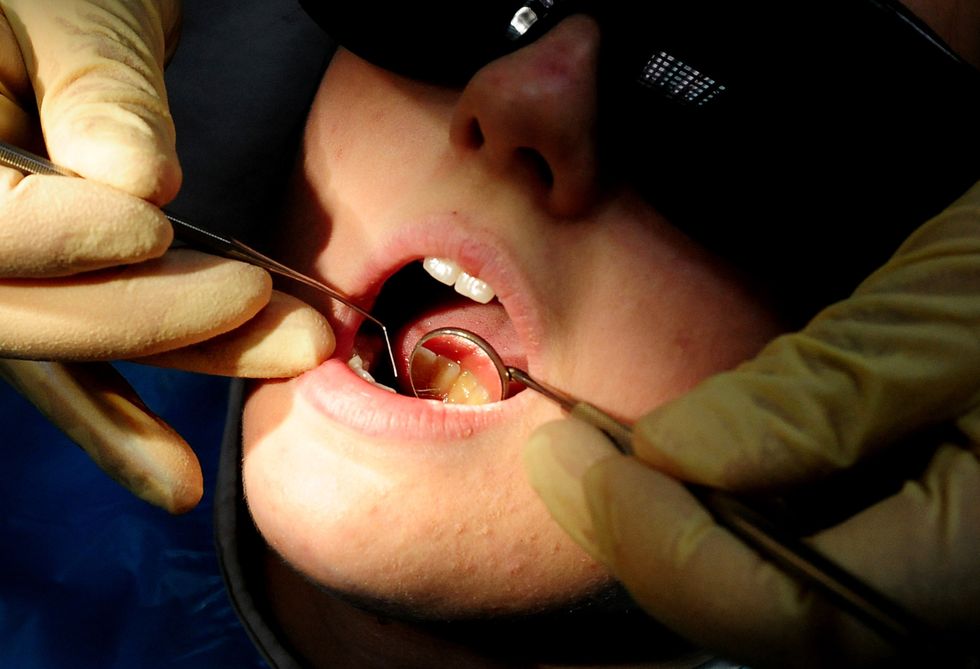 Child dental treatments down 70% in the year after lockdown