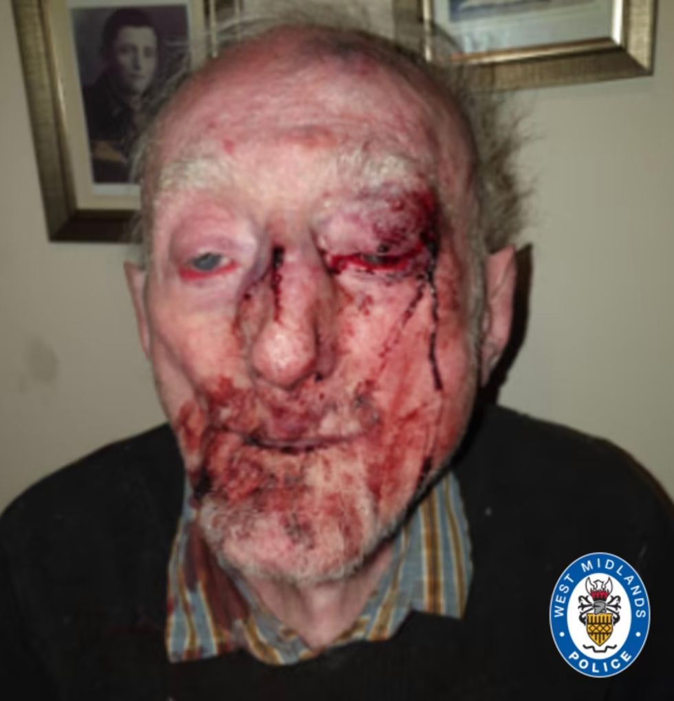 Man, 87, left with horrific injuries after being attacked by drug addict in his home