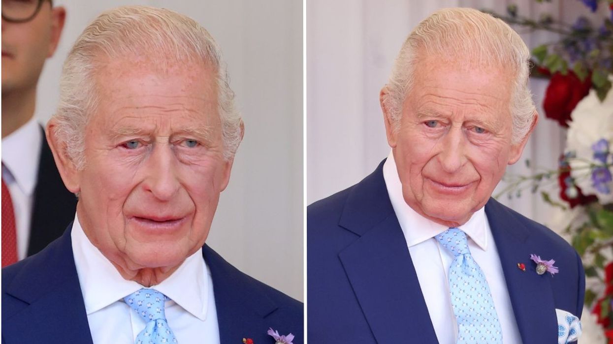 Buckingham Palace issues update as King Charles suffers burst blood vessel in his eye