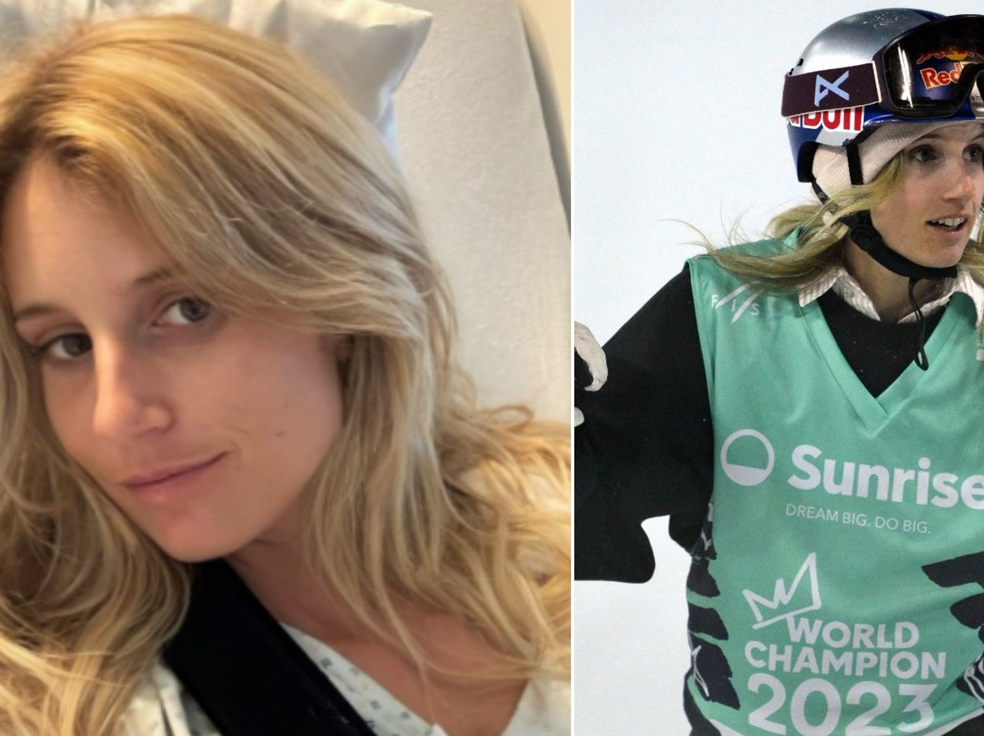 Olympic champion suffers agonising injury as arm ripped from socket in 'freak accident'