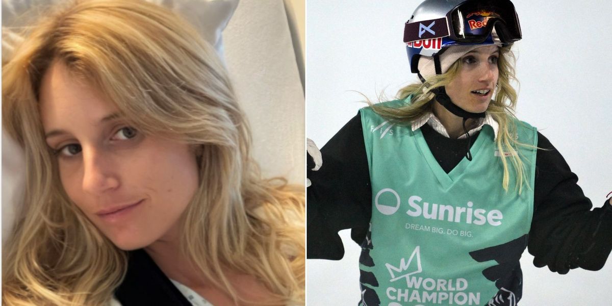 Olympic champion suffers agonising injury as arm ripped from socket in ‘freak accident’ Olympic champion suffers agonising injury as arm ripped from socket in ‘freak accident’