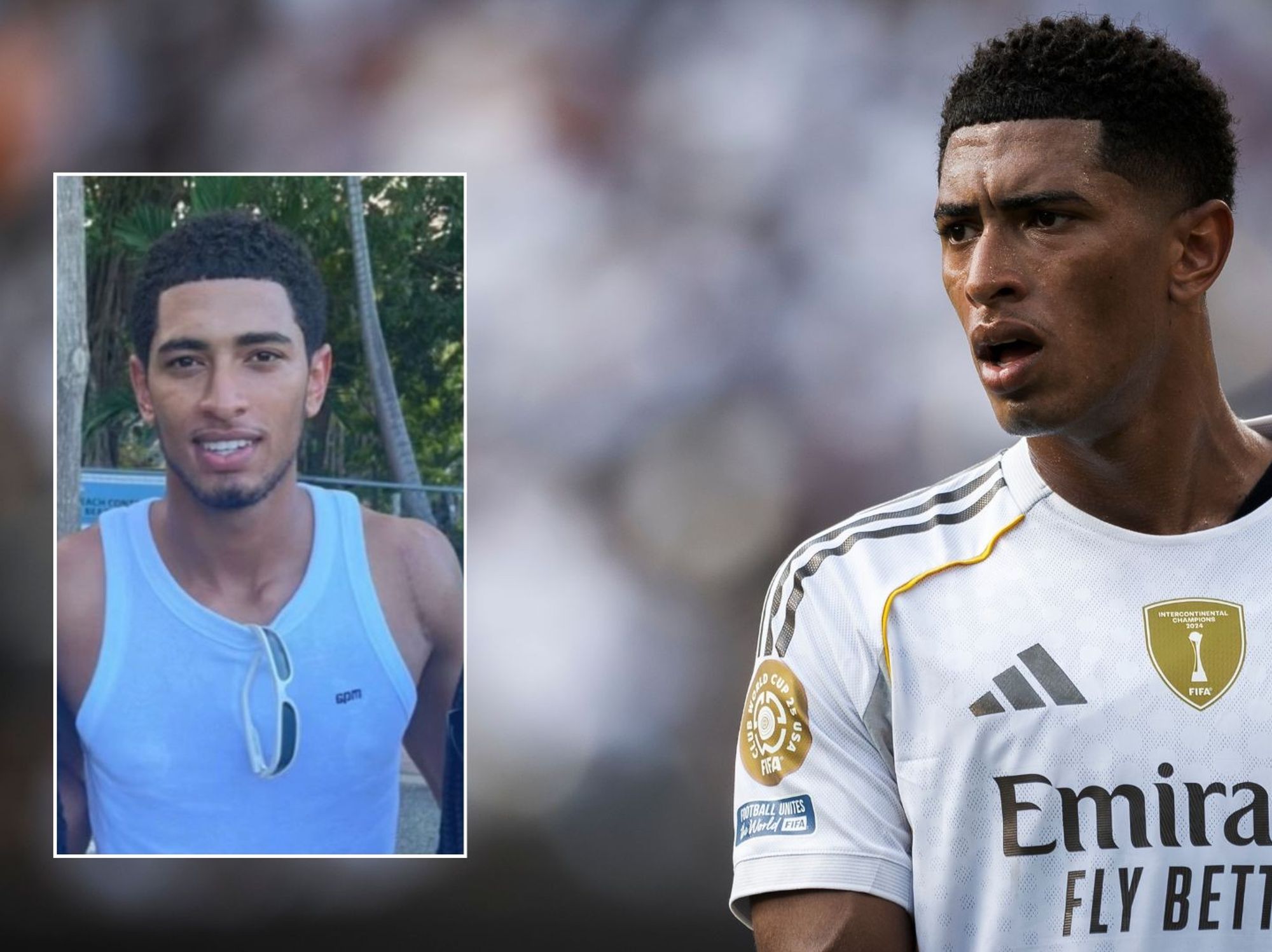 Jude Bellingham sports major scar following shoulder surgery that will see him out for months