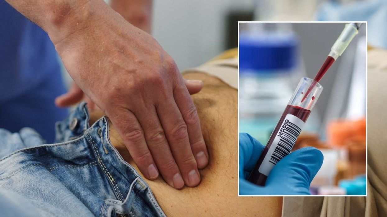Groundbreaking blood test detects 50 different types of cancer - 'Seven times as many as other screening programmes put together'