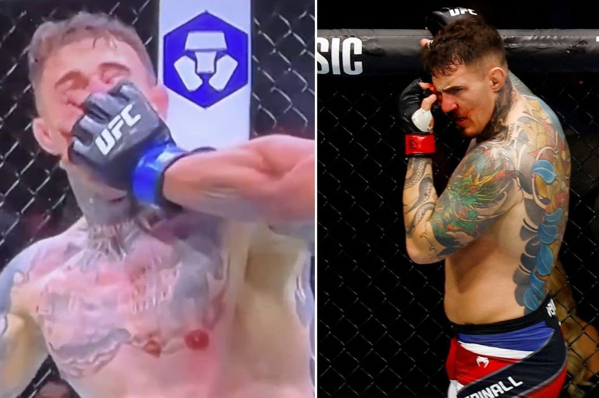 Tom Aspinall hospitalised after horrific eye injury suffered at UFC 321