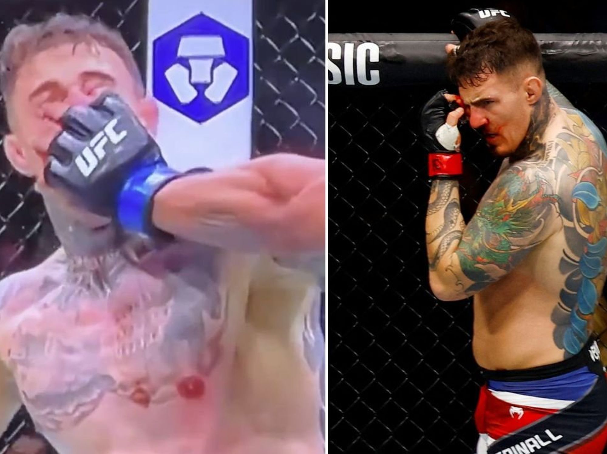 Tom Aspinall hospitalised after horrific eye injury suffered at UFC 321