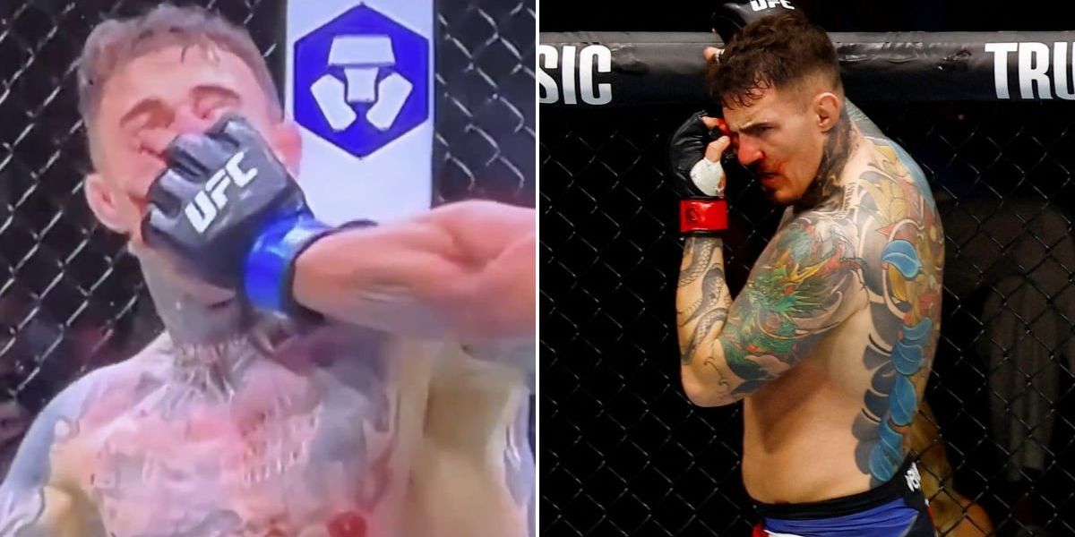 Tom Aspinall hospitalised after horrific eye injury suffered at UFC 321 Tom Aspinall hospitalised after horrific eye injury suffered at UFC 321