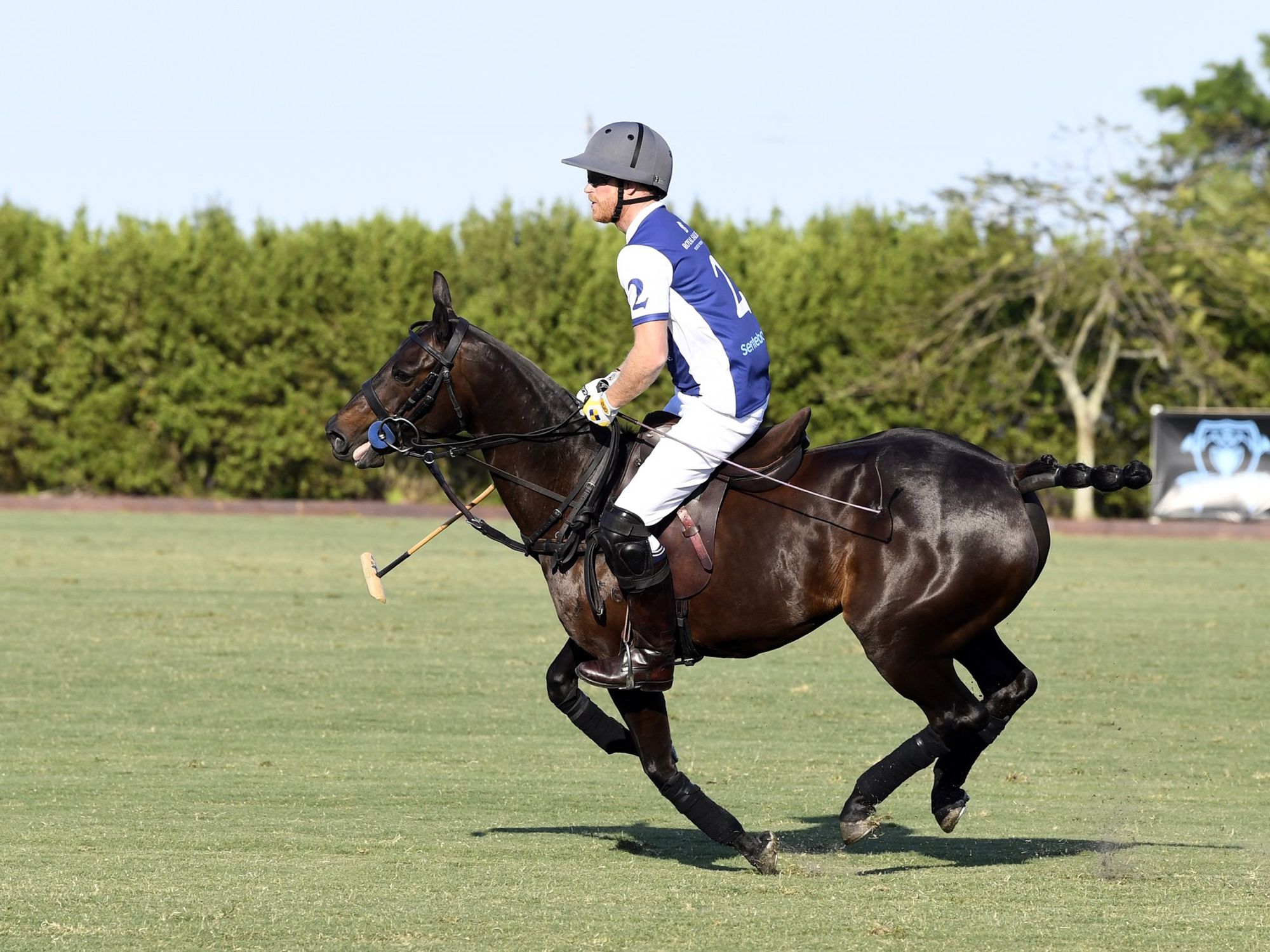 Prince Harry suffers injury during polo match