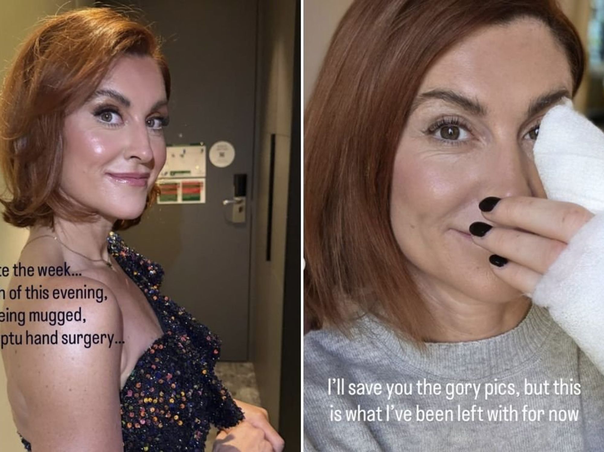 TNT Sports presenter details London mugging after 'hooded man on bike' attack that left her screaming