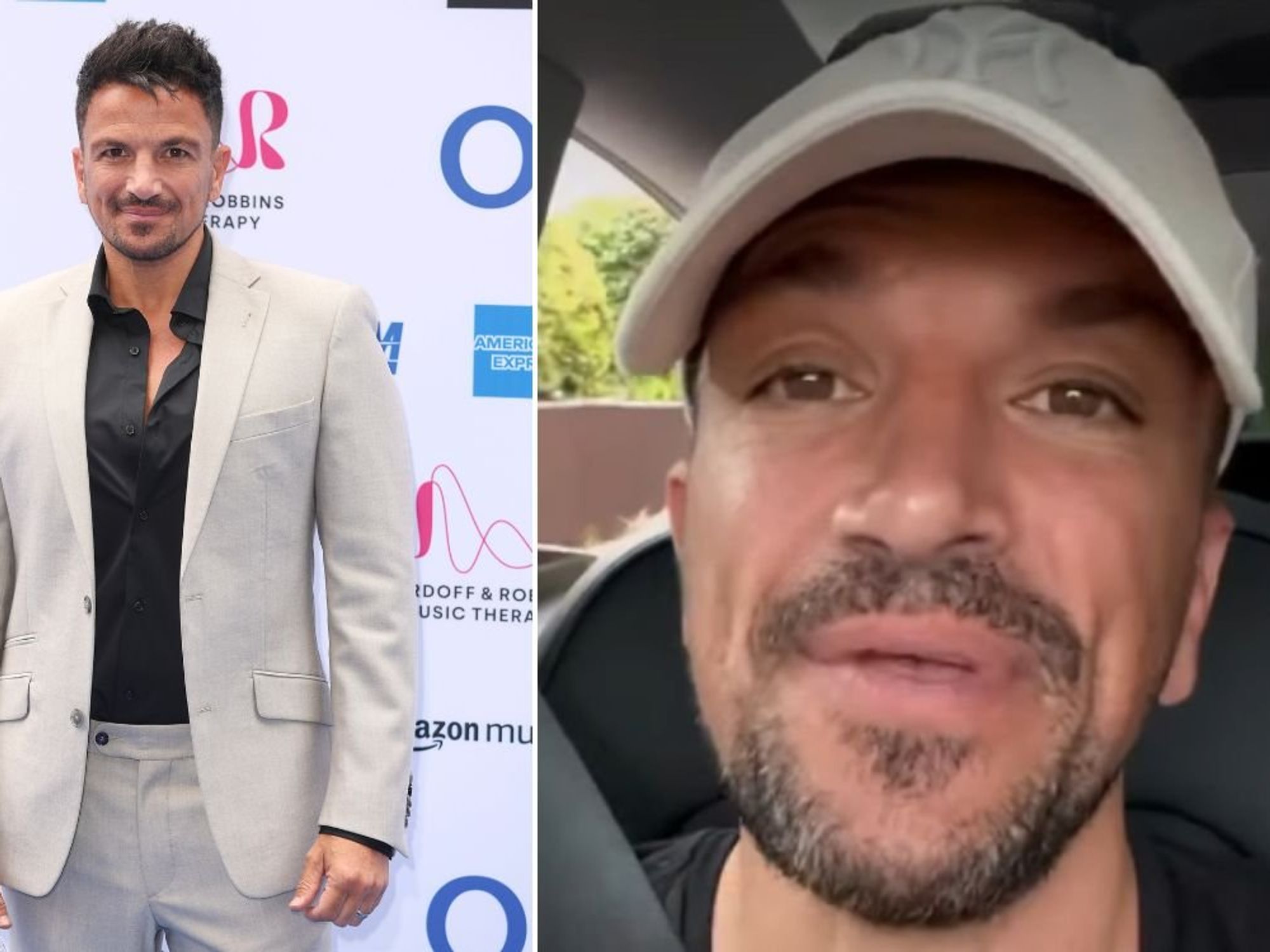 Peter Andre rushed for emergency treatment after being kicked in the face by fan: 'I was in absol...