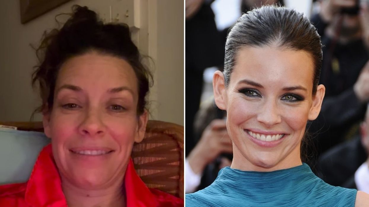 Marvel star shares news of brain injury following frightening accident