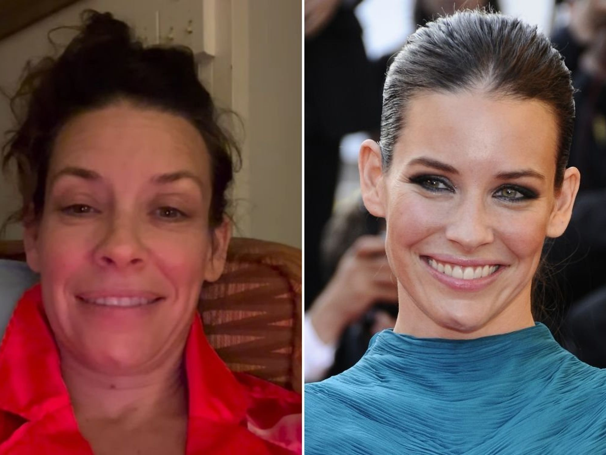 Marvel star shares news of brain injury following frightening accident