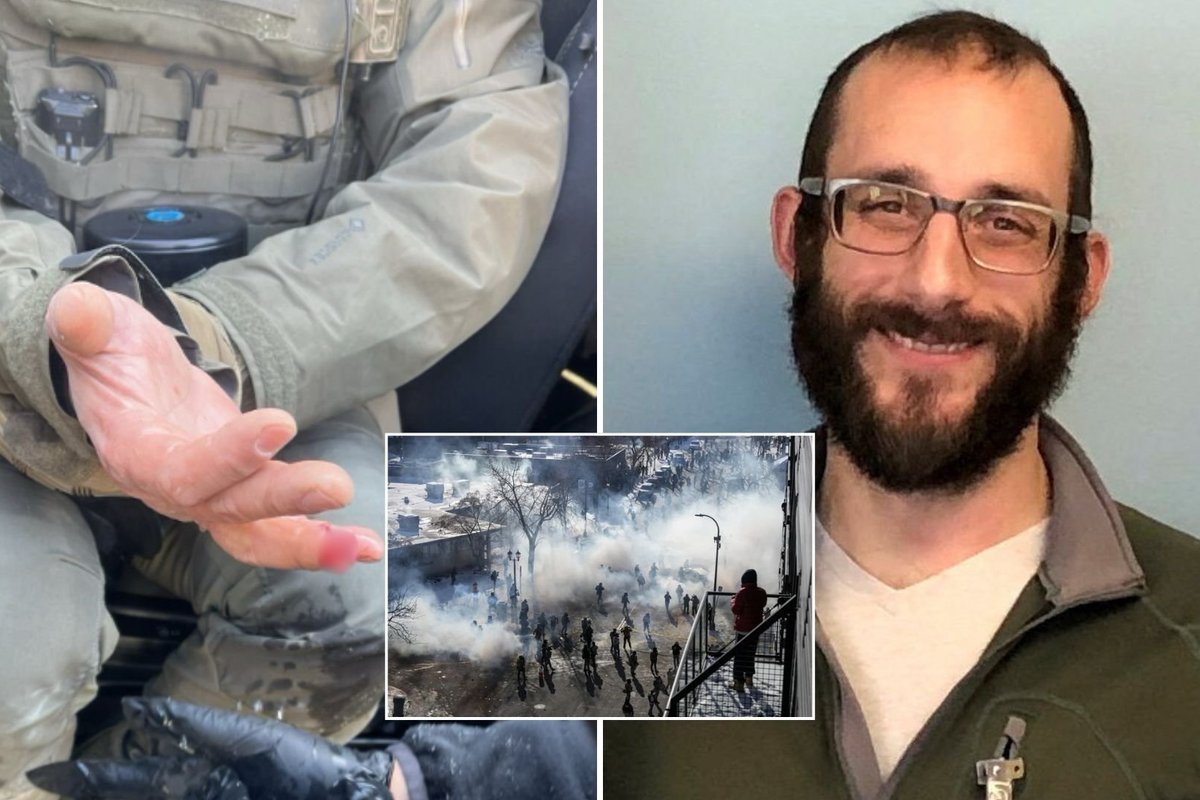 Minneapolis rioters 'bite off' officer's finger as protests erupt after fatal shooting of nurse